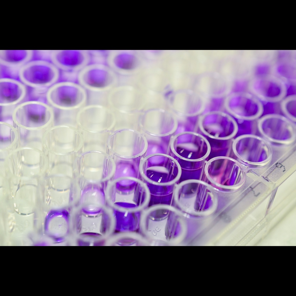 Human soluble tumor necrosis factorsize:like weak inducer of apoptosis  sTWEAK ELISA Kit size: 96 Tests